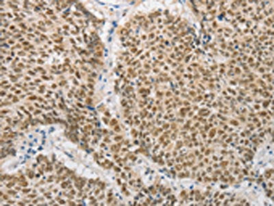 DNAJB1 Antibody