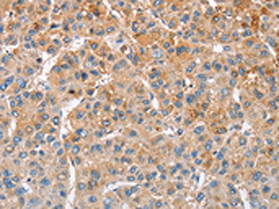 MTMR4 Antibody