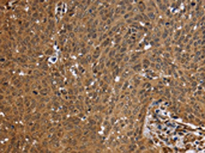 FHL2 Antibody