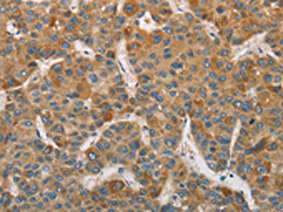 DDX53 Antibody