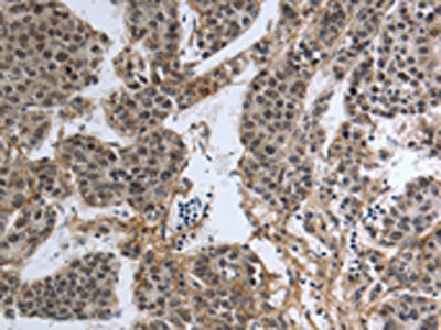 PMS2 Antibody