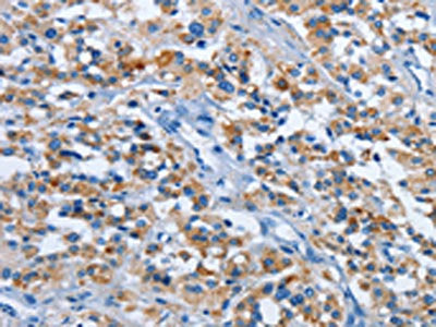 ETHE1 Antibody