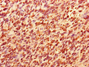 TCEAL8 Antibody