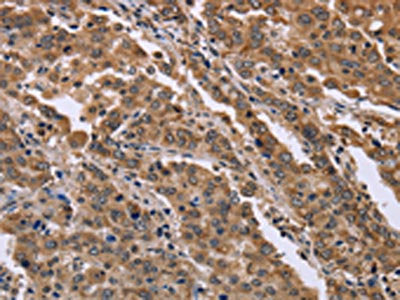 FAM3B Antibody