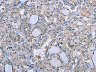 FES Antibody