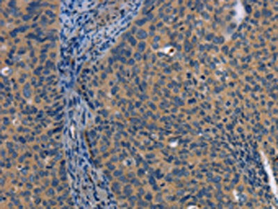 LATS1 Antibody