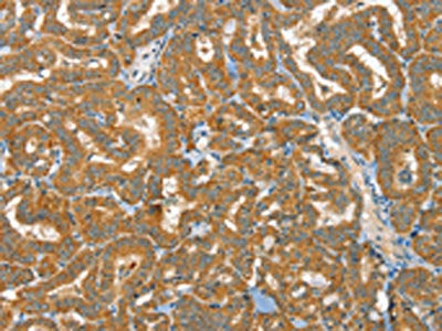 RAB25 Antibody