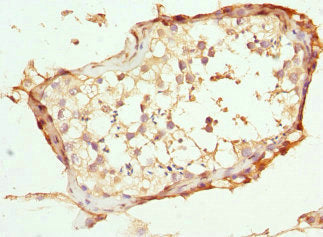 ABCC11 Antibody