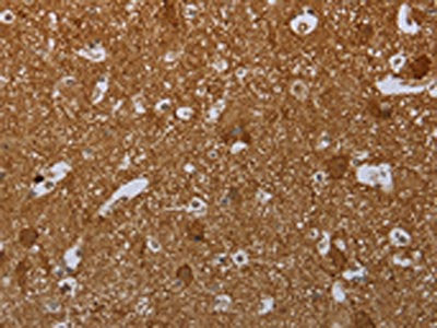 MARK1 Antibody