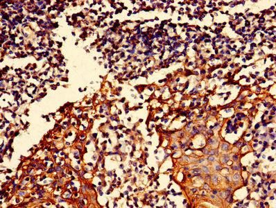 S100A16 Antibody