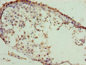 SLC26A8 Antibody