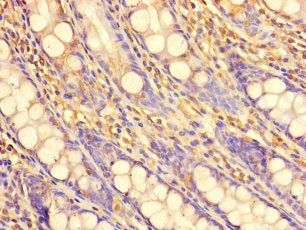 PDIK1L Antibody