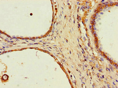 SPPL2A Antibody