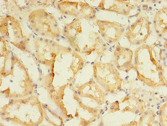 SPIRE2 Antibody