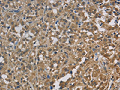 CYB5A Antibody