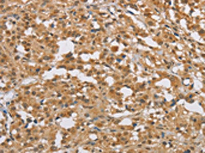 DIDO1 Antibody