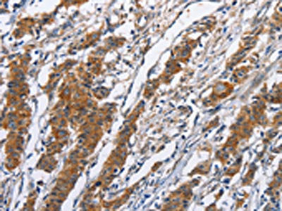 NCAPD3 Antibody