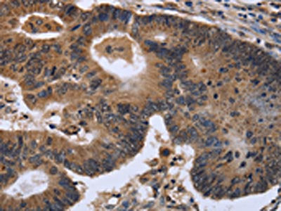FGF21 Antibody