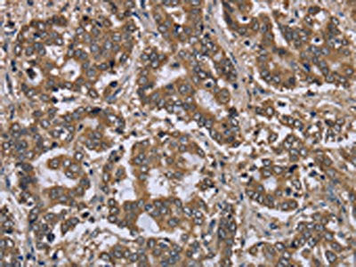 FGL2 Antibody