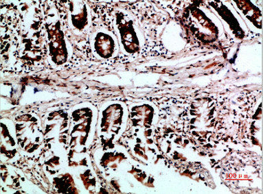 VHL Antibody