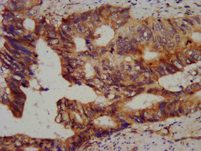 CHMP5 Antibody