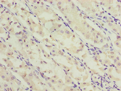 SLC52A2 Antibody
