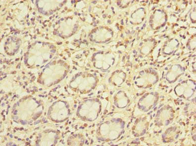 PCIF1 Antibody