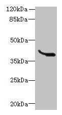 LRTM1 Antibody