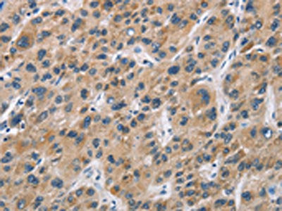 CYP21A2 Antibody