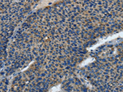 TLR4 Antibody