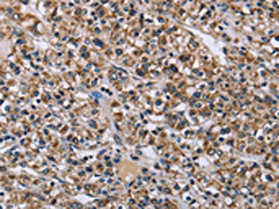 KCNJ11 Antibody