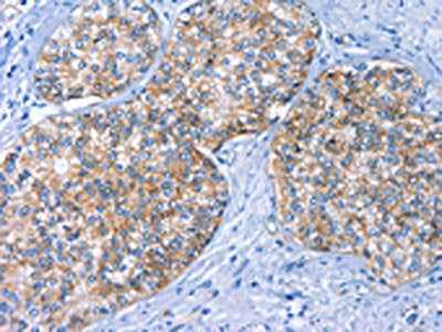 BCAM Antibody