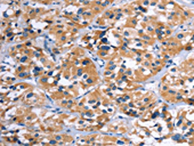 COMP Antibody