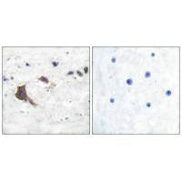 HSD17B10 Antibody