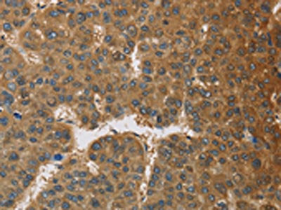 TNFRSF10D Antibody