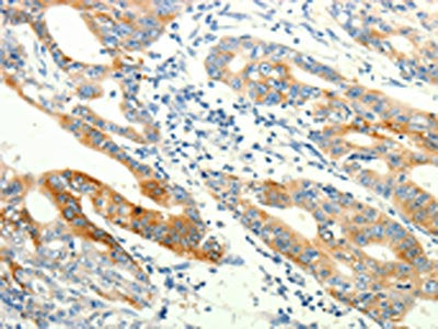 TRPA1 Antibody