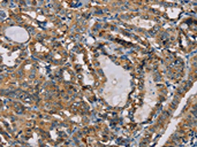 CENPU Antibody