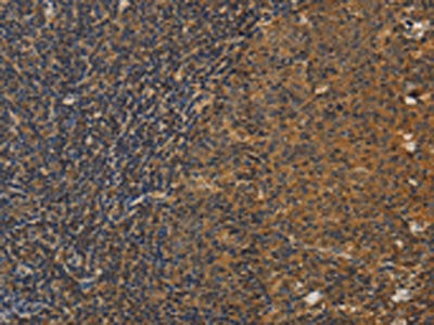 DCTN5 Antibody