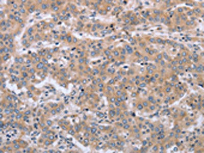 MAPRE3 Antibody