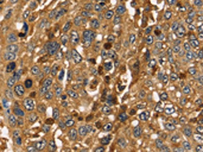 TMSB4X Antibody