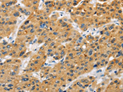 BTLA Antibody