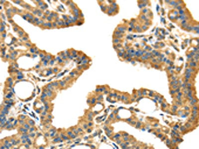 IL3RA Antibody