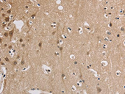 ELOVL1 Antibody
