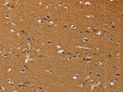 CHRNA4 Antibody