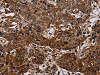 SLC1A6 Antibody