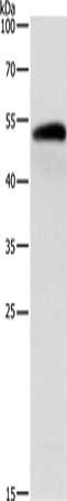 ALDH1B1 Antibody
