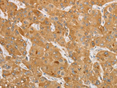 NGF Antibody