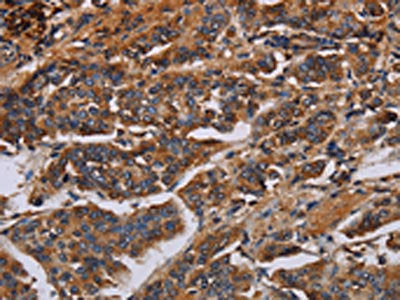 KCNQ1 Antibody