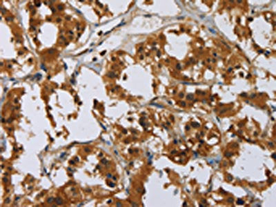 GATA5 Antibody