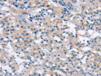 PLEKHO1 Antibody